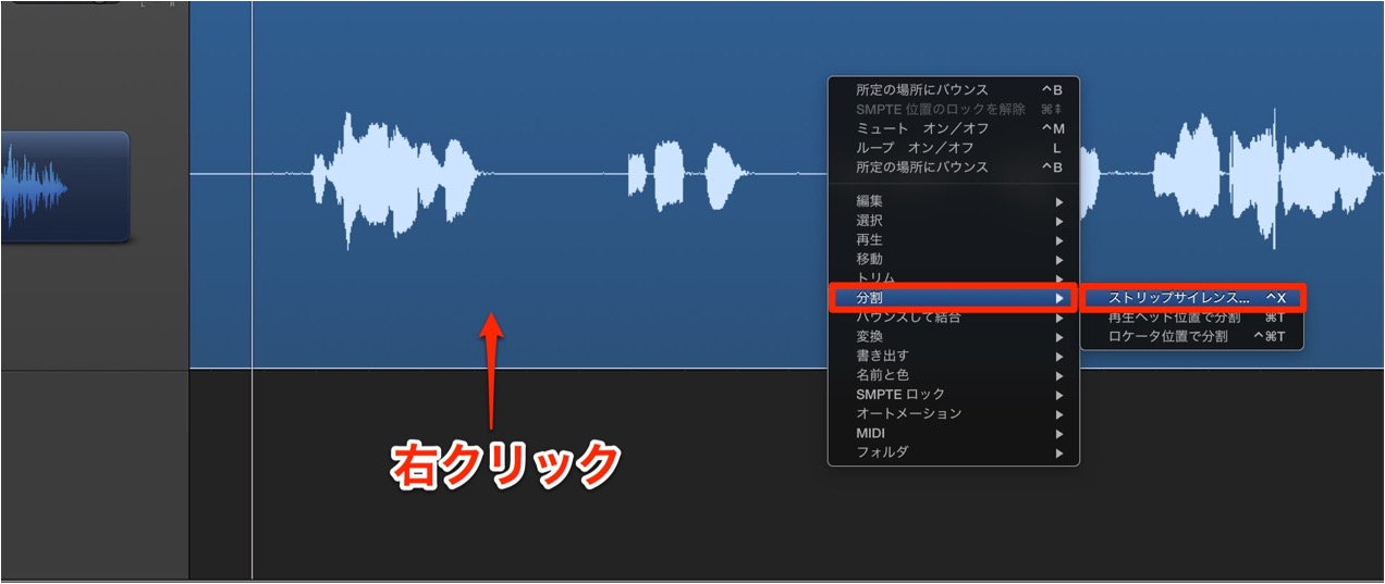ストリップサイレンス