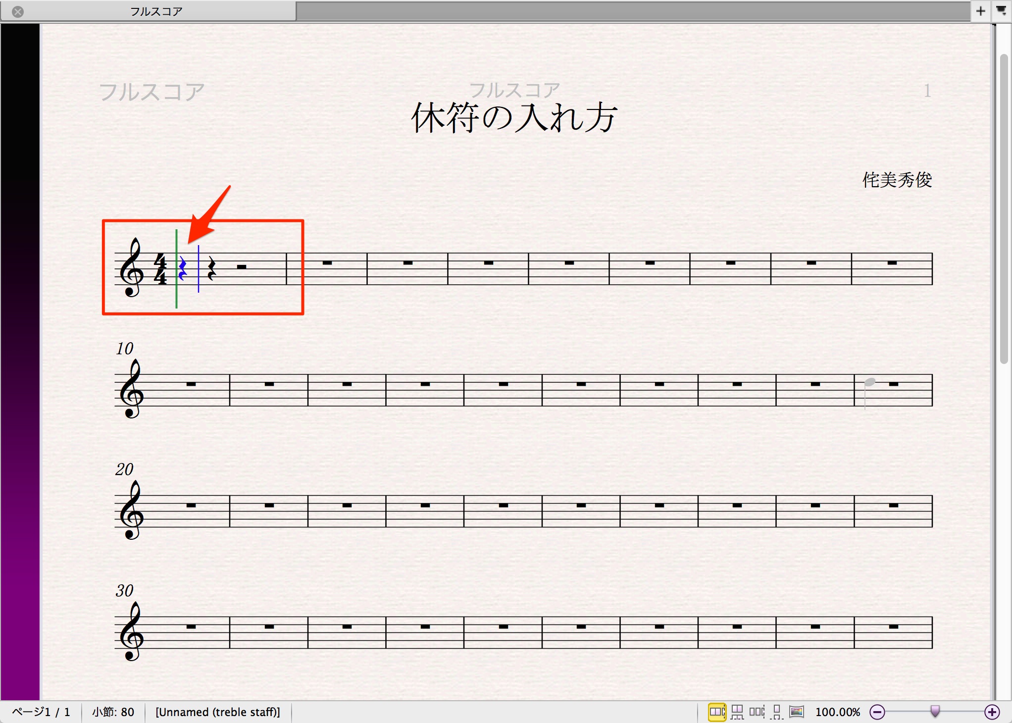 休符の入れ方