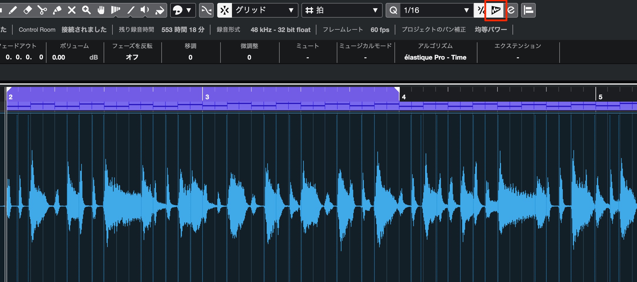クオンタイズ_Audio
